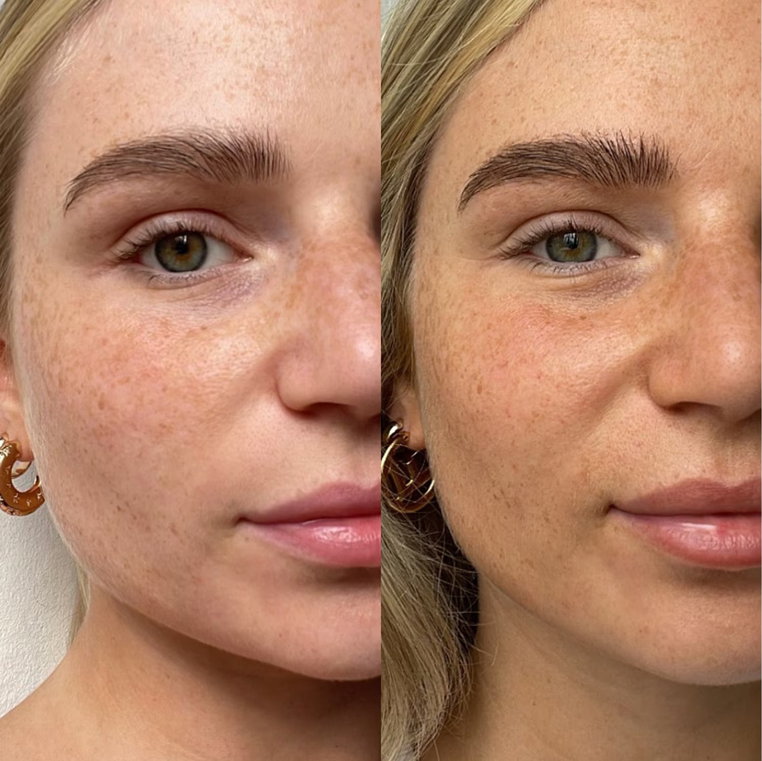 Hyaluronic Acid self-tanning Serum